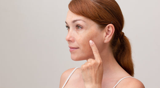 How to Remove Dark Spots Naturally with Vitamin C and Green Tea